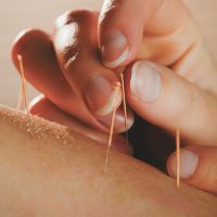 Acupuncture offers a whole body approach to treat a wide...