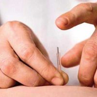 Chronic fatigue can be debilitating. Acupuncture can help.