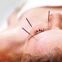 Chronic retinal diseases were shown to improve using acupuncture in this study: