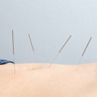 The good news? Acupuncture may very well be one of the best healing modalities for the management of PMS.