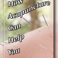 Still not sure about acupuncture? Here’s everything you need to know.