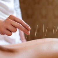 Acupuncture helps with more than you may realize!