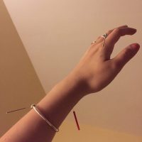 Check out why this well-known blogger tried acupuncture and how it worked for her!